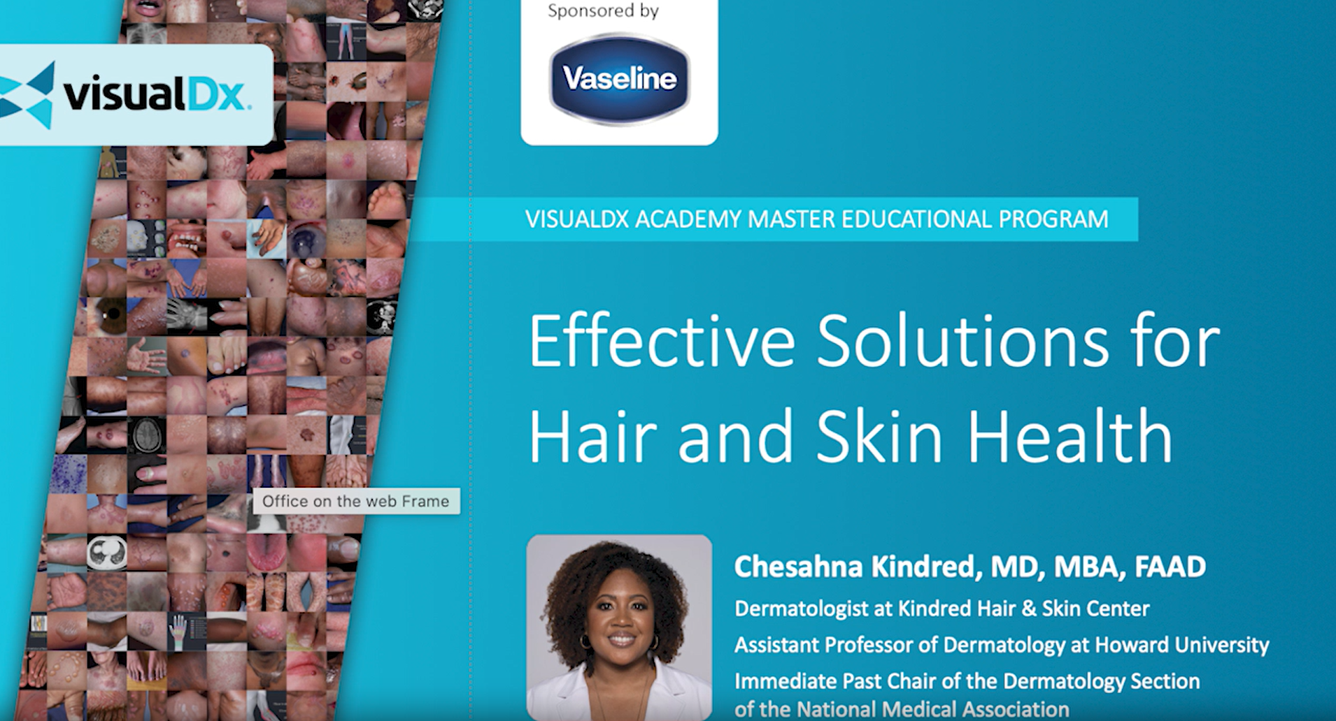 Cover Photo of Dr. Chesahna Kinred's Webinar on Effective Solutions for Hair and Skin Health